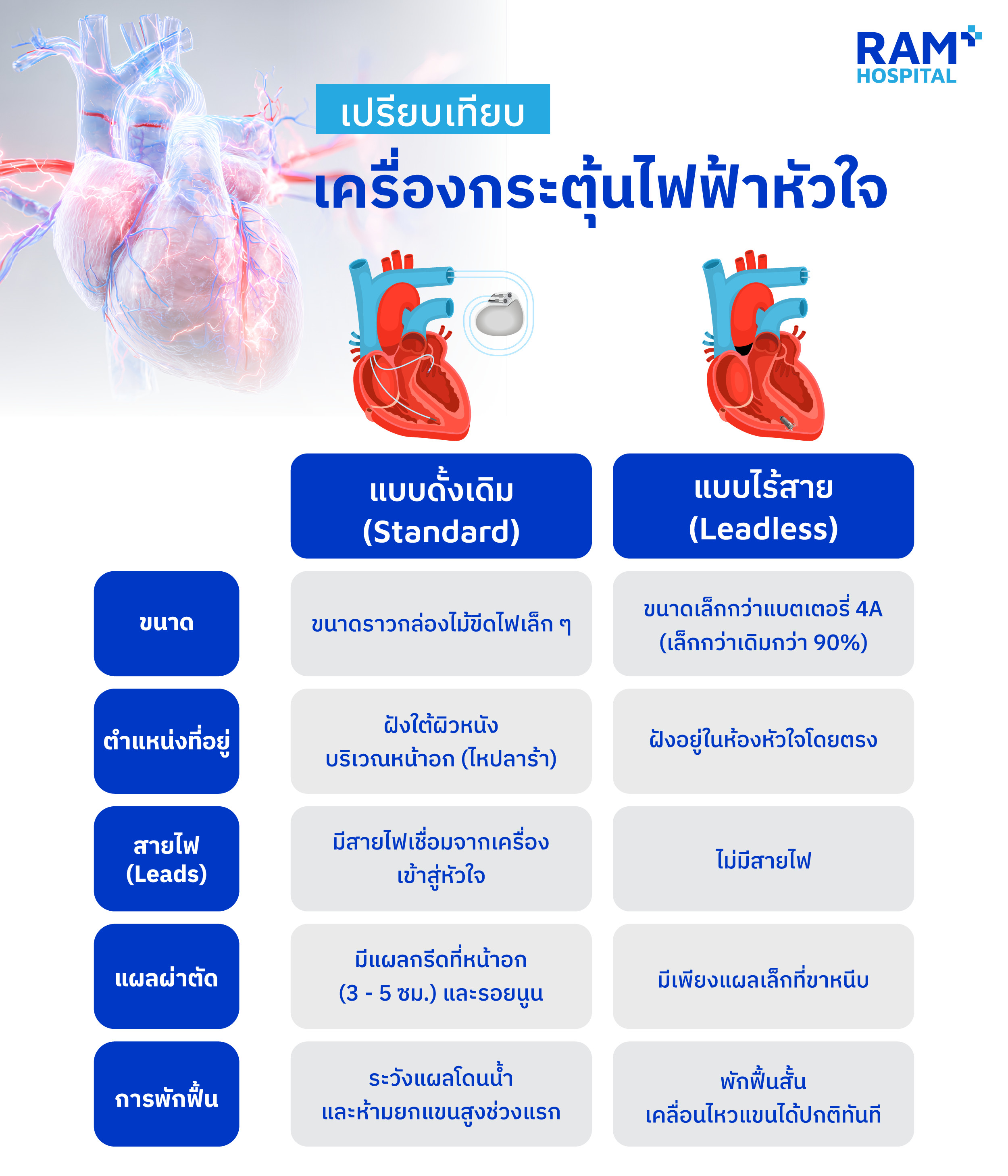 เครื่องกระตุ้นหัวใจแบบไร้สาย