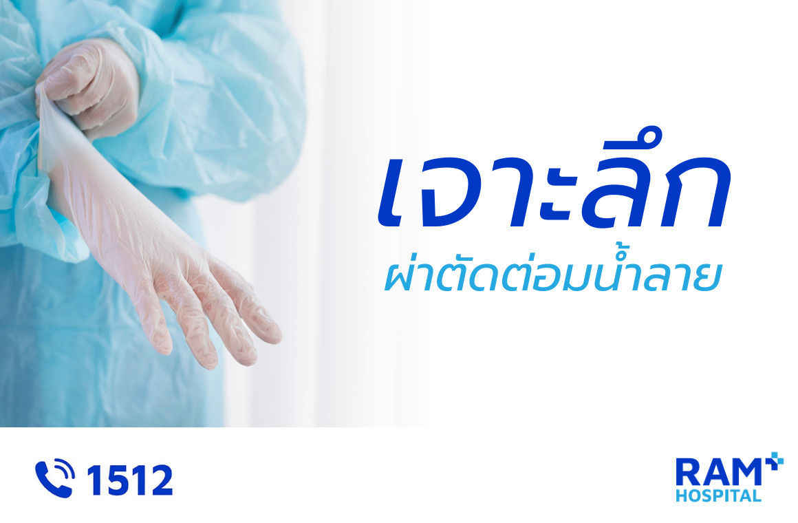 ผ่าตัดต่อมน้ำลายส่องกล้อง