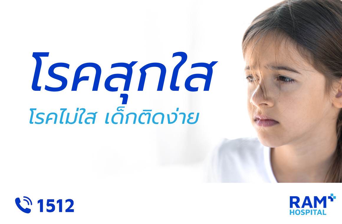 อีสุกอีใส