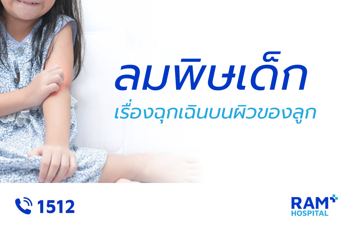 ผื่นลมพิษเด็ก