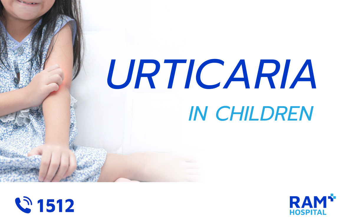 urticaria in children