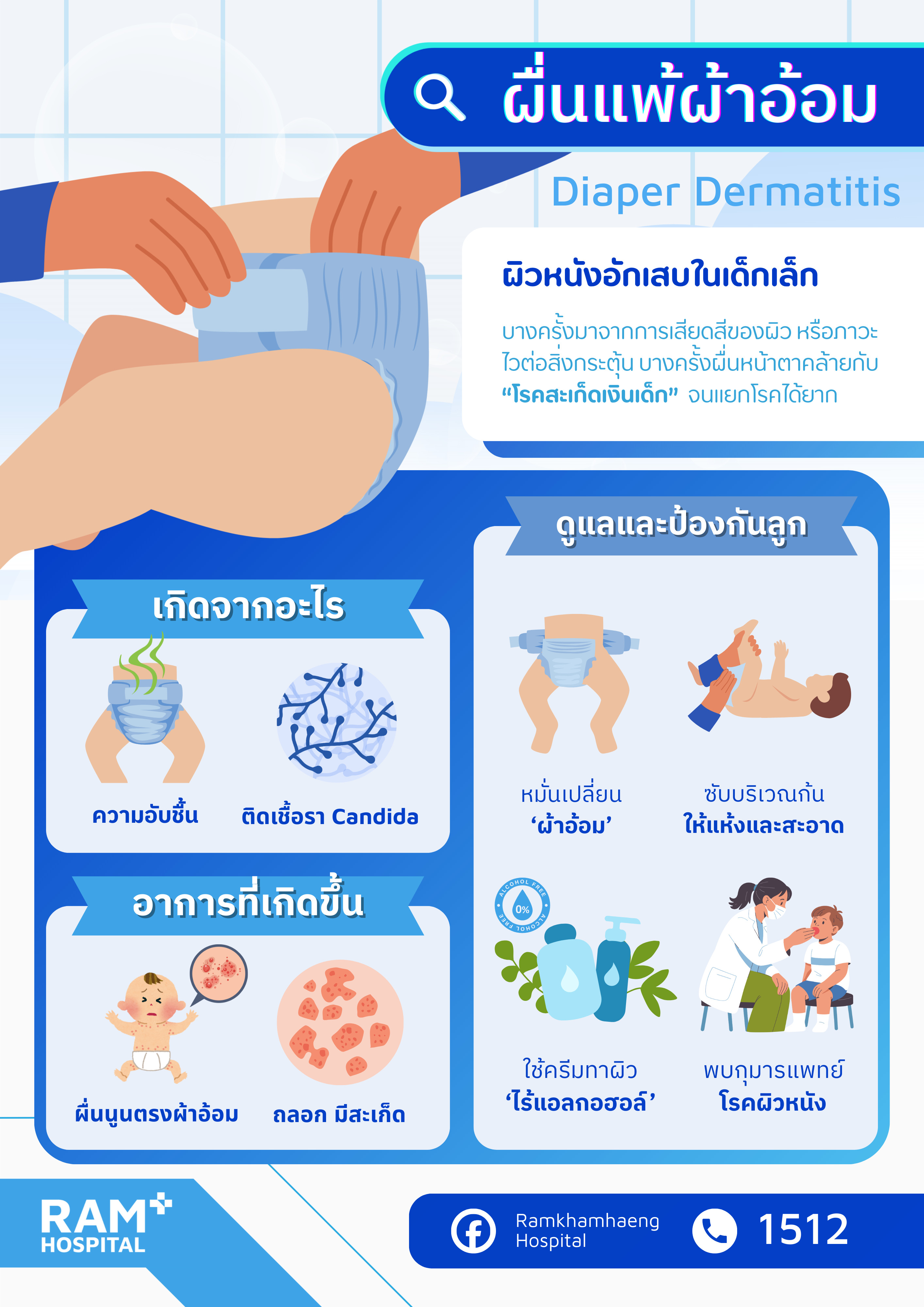 ผื่นแพ้ผ้าอ้อม