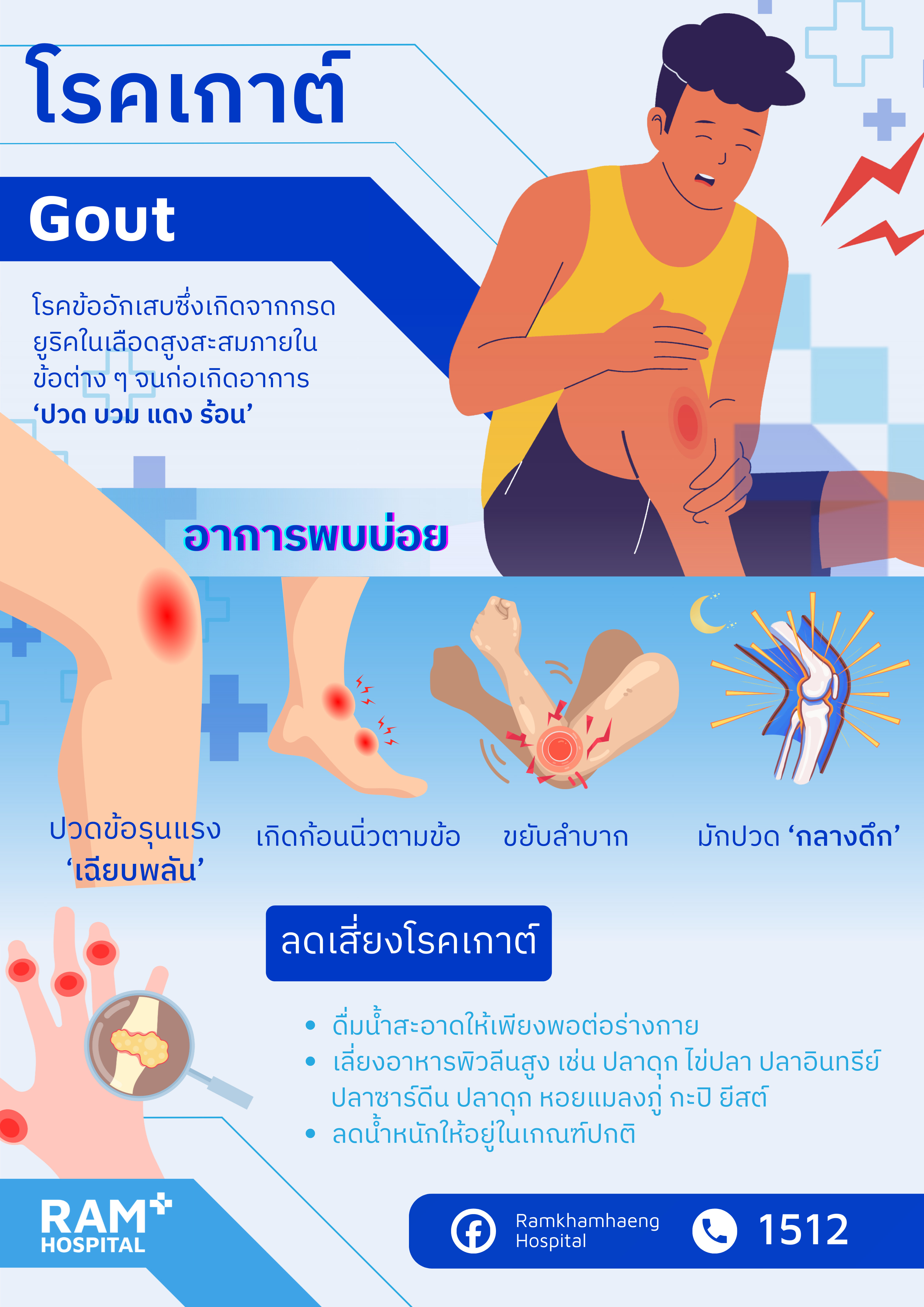 โรคเกาต์