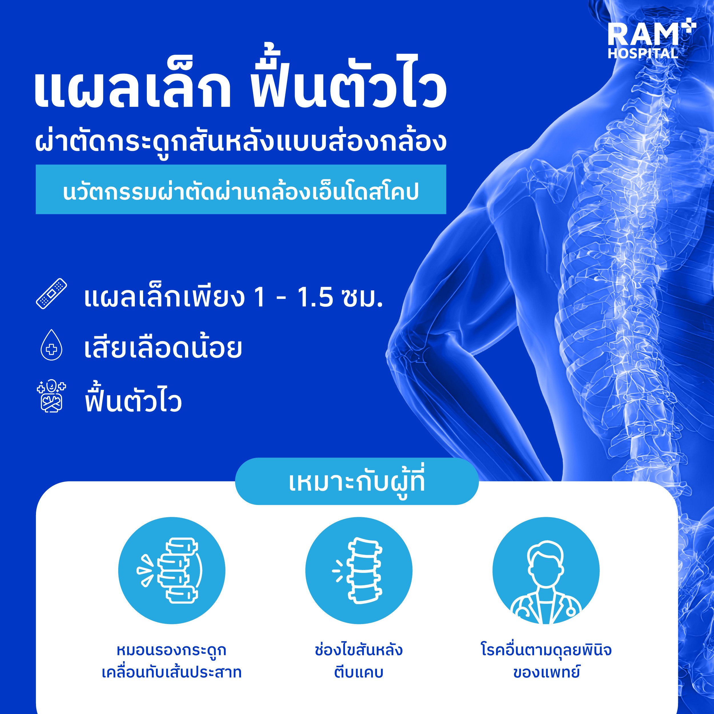 ผ่าตัดกระดูกสันหลังแผลเล็ก