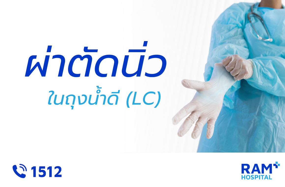 ผ่าตัดนิ่วในถุงน้ำดีส่องกล้อง