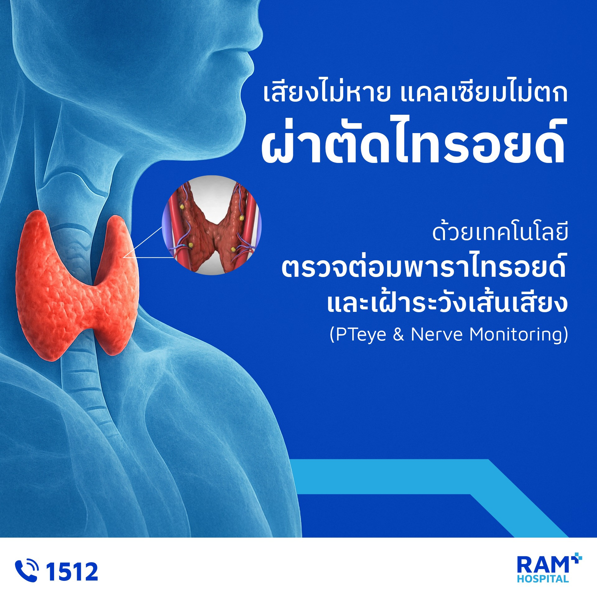 ผ่าตัดไทรอยด์ส่องกล้อง