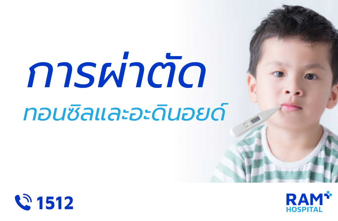 ผ่าตัดทอนซิลอะดินอย