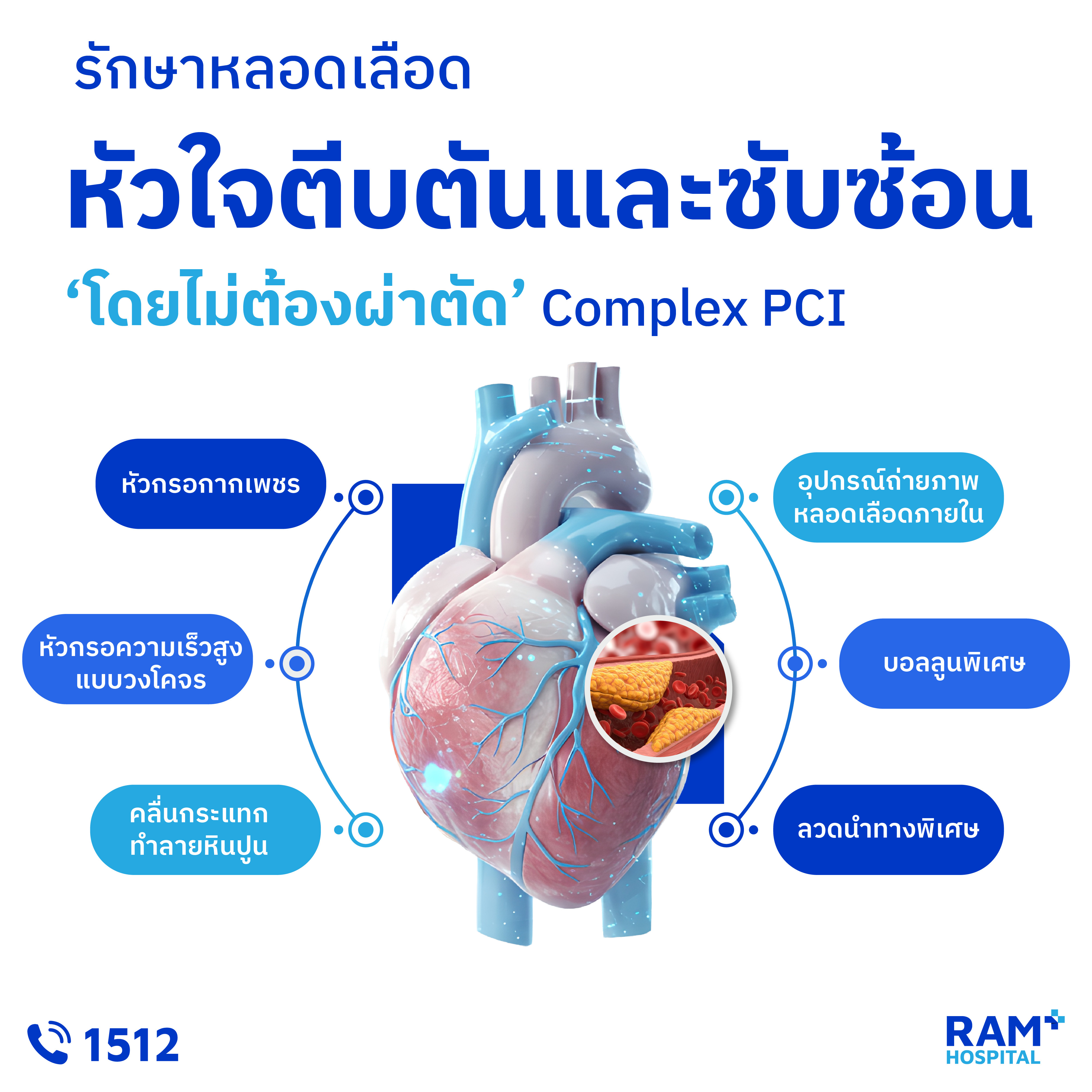 รักษาหัวใจตีบซับซ้อนที่มีหินปูนเกาะหนา complex PCI