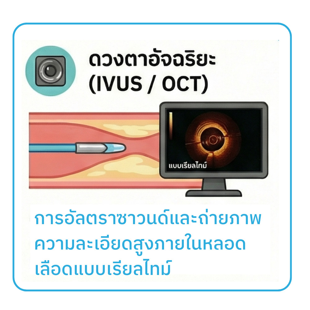 รักษาหัวใจตีบซับซ้อนที่มีหินปูนเกาะหนา complex PCI