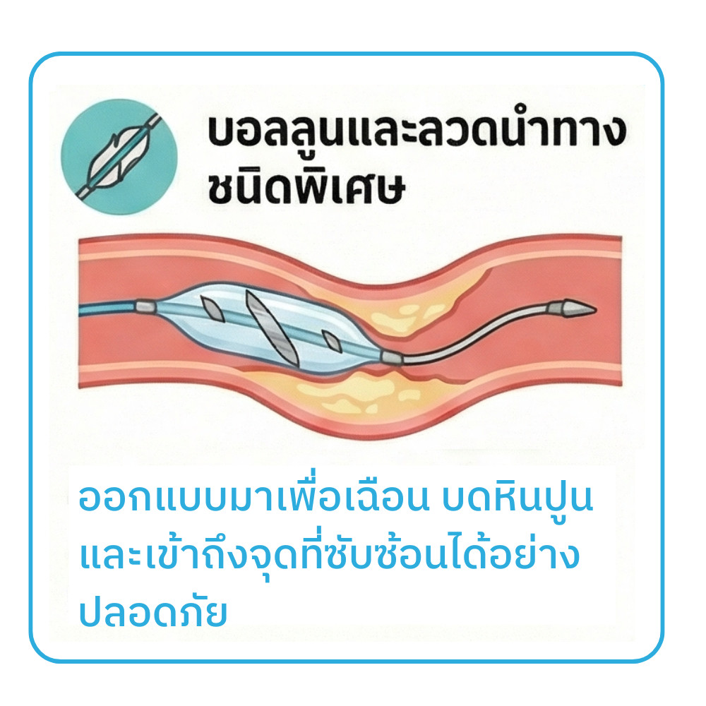 รักษาหัวใจตีบซับซ้อนที่มีหินปูนเกาะหนา complex PCI