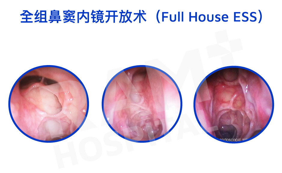 耳鼻喉内镜手术中心