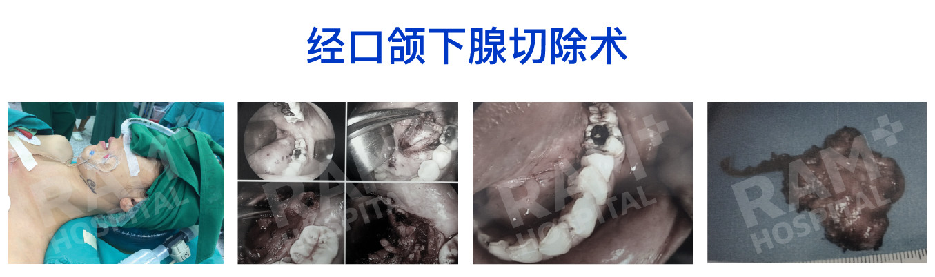 耳鼻喉内镜手术中心