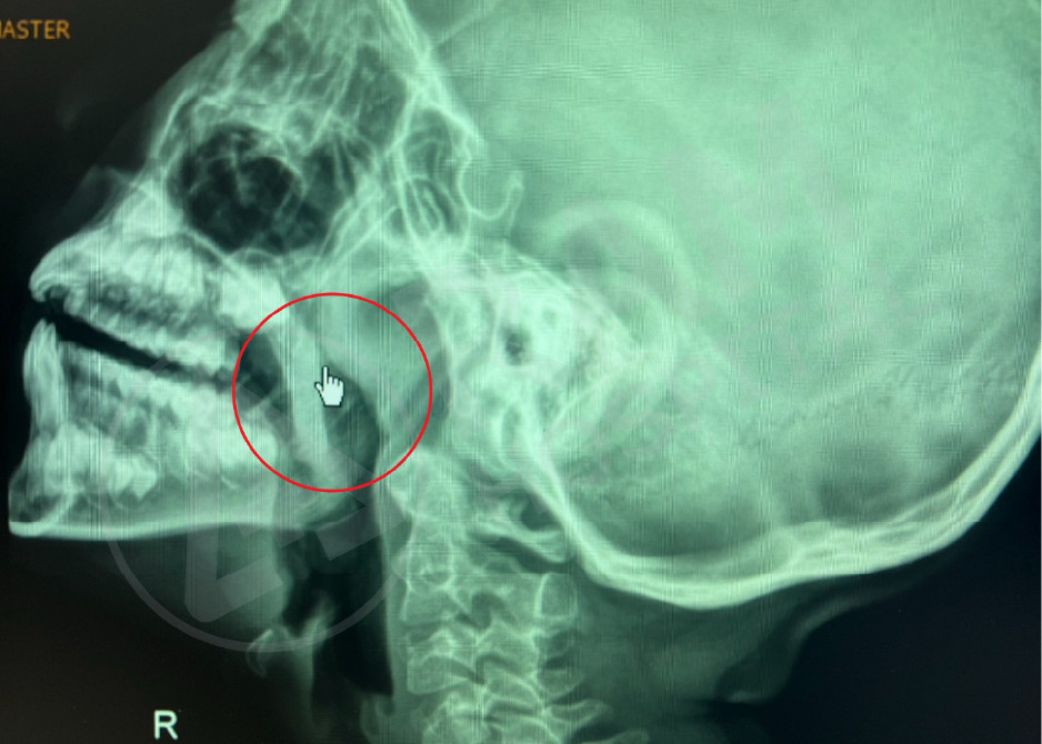 耳鼻喉内镜手术中心