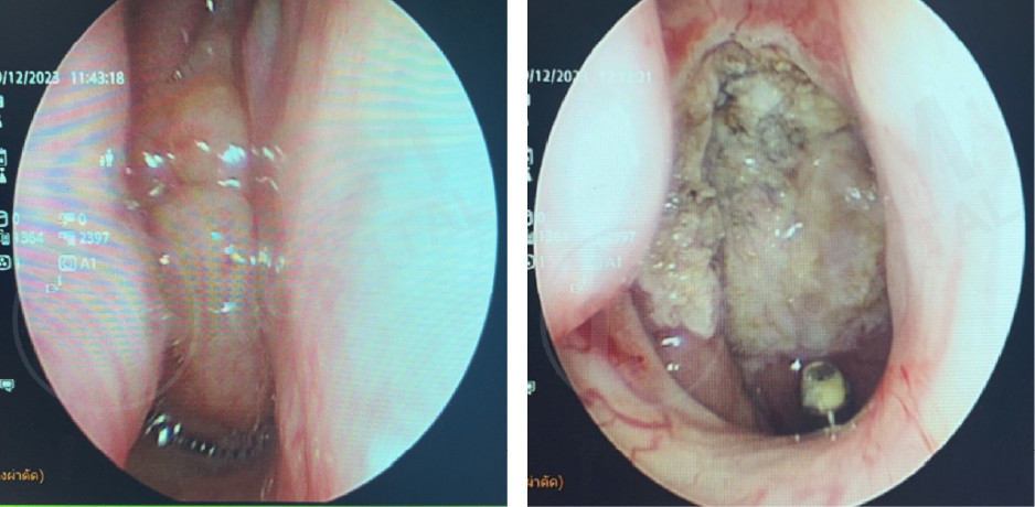 耳鼻喉内镜手术中心