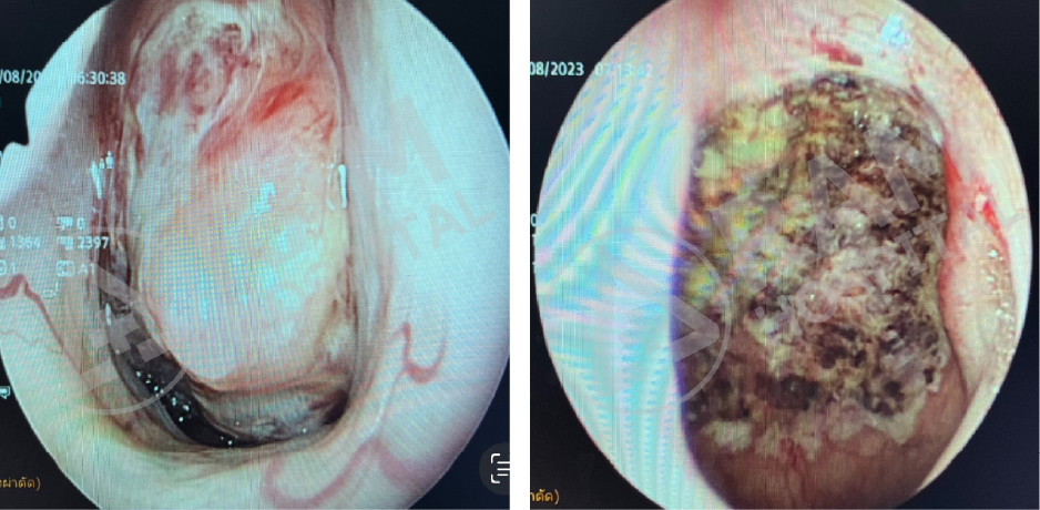 耳鼻喉内镜手术中心