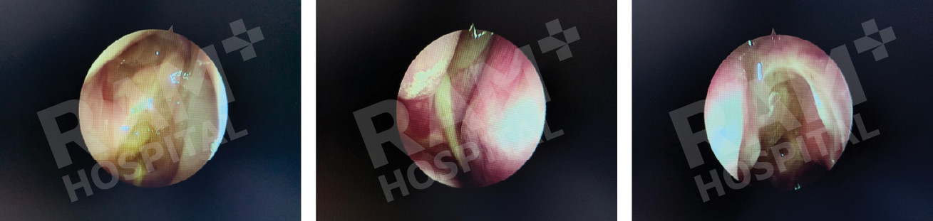 耳鼻喉内镜手术中心