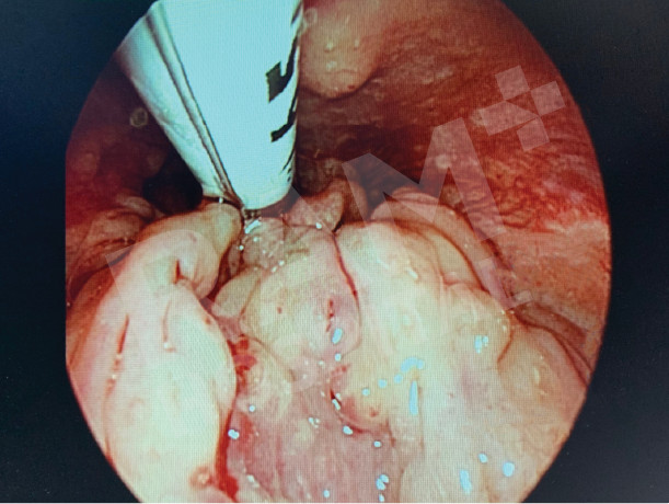耳鼻喉内镜手术中心