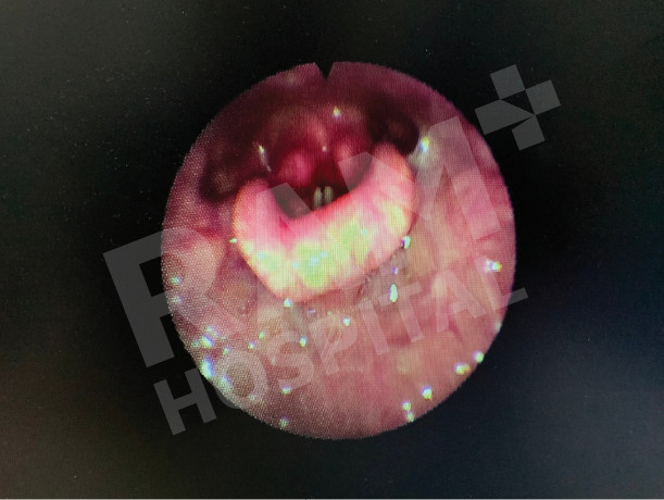 耳鼻喉内镜手术中心
