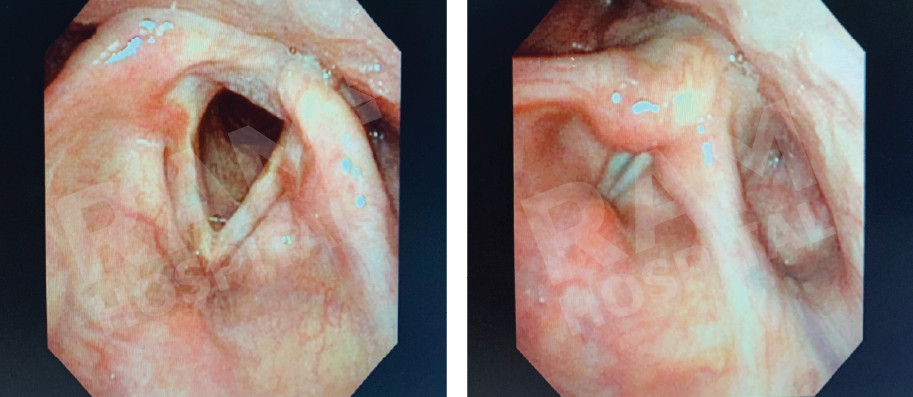 耳鼻喉内镜手术中心