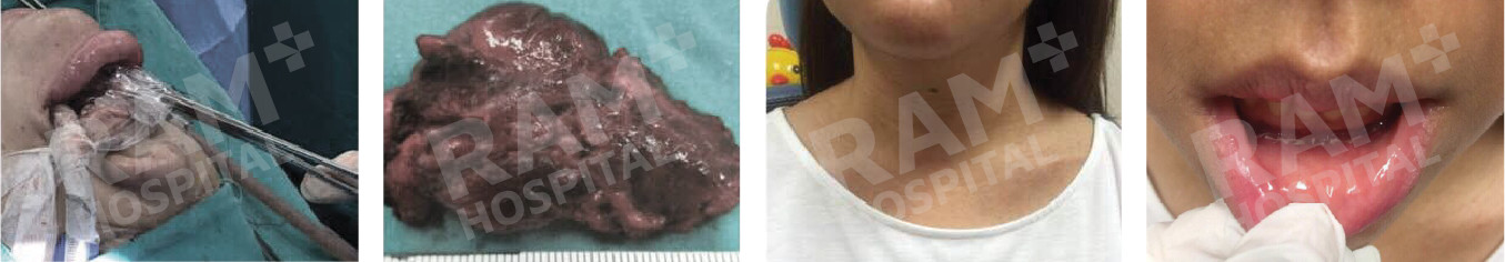 耳鼻喉内镜手术中心