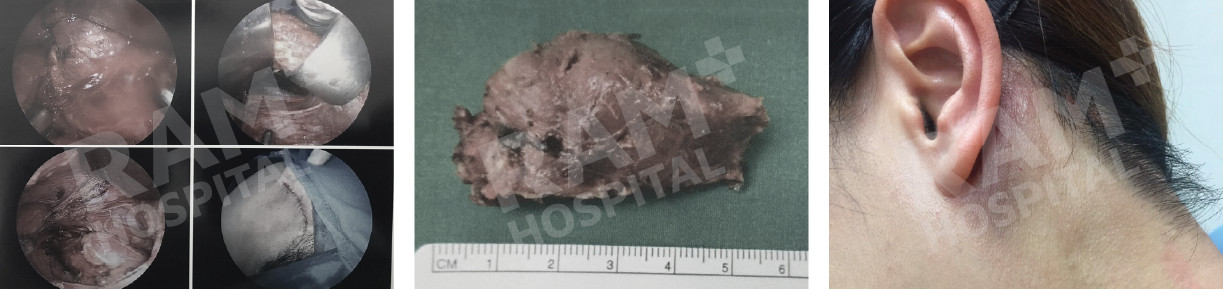 耳鼻喉内镜手术中心