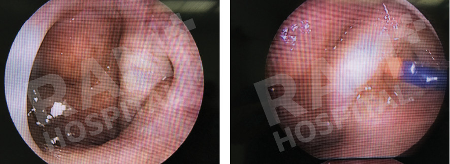耳鼻喉内镜手术中心