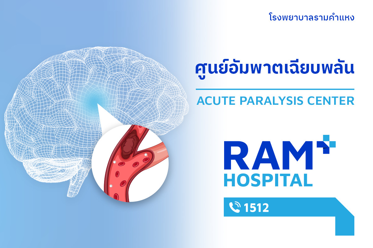 ศูนย์อัมพาตเฉียบพลัน