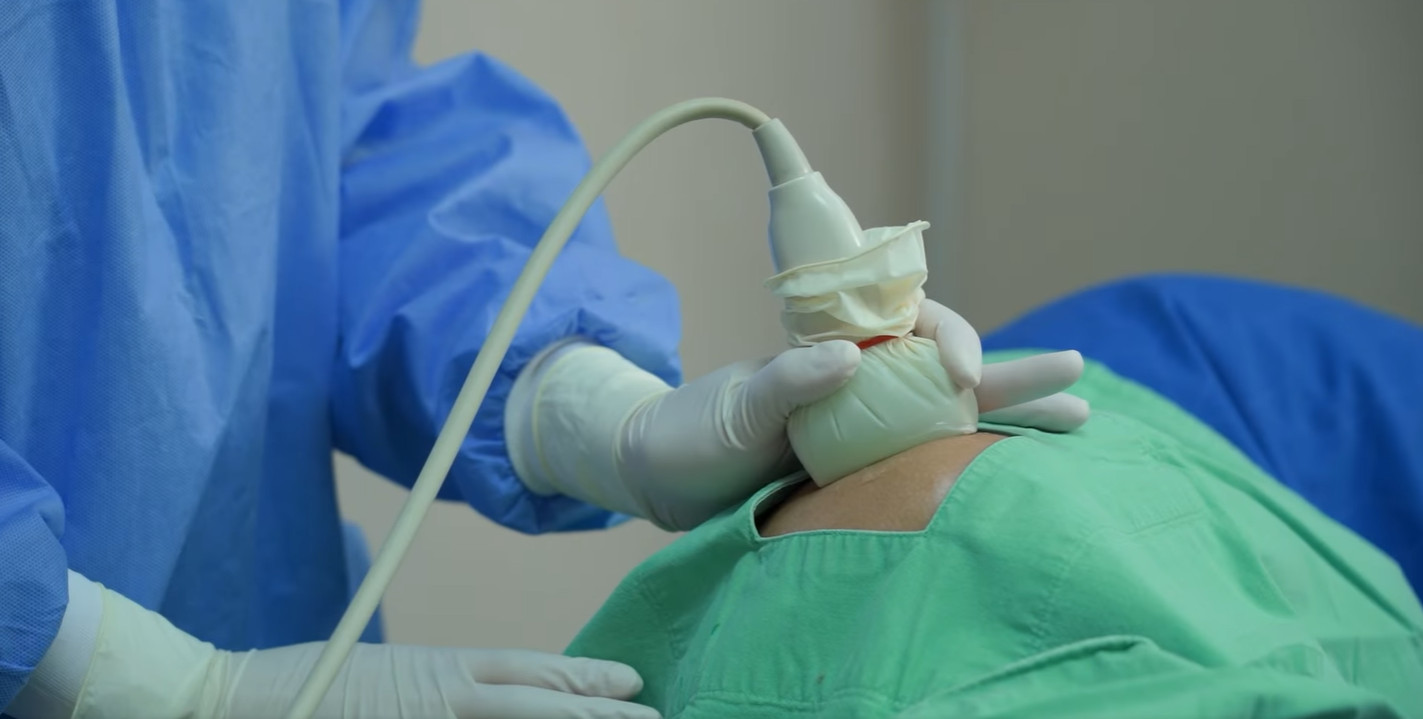 รักษาปวดเรื้อรัง