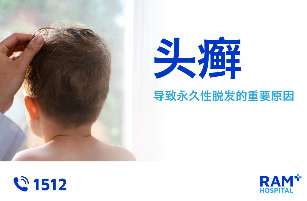 头癣