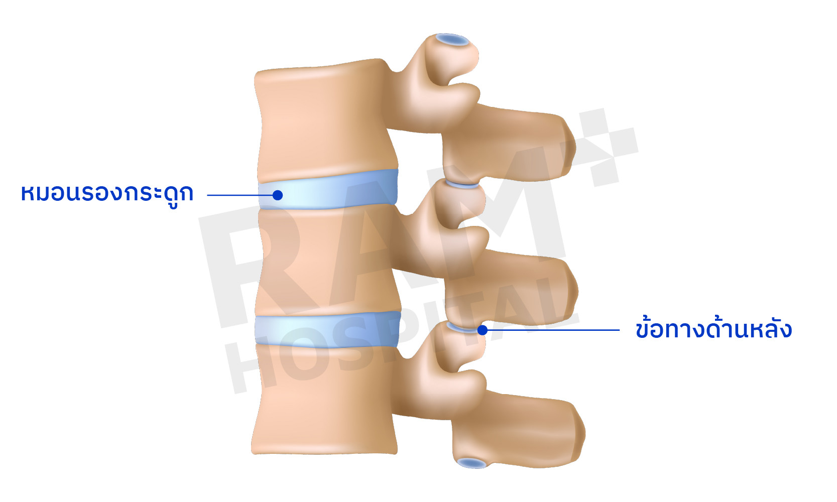 หมอนรองกระดูกสันหลังส่วนเอว