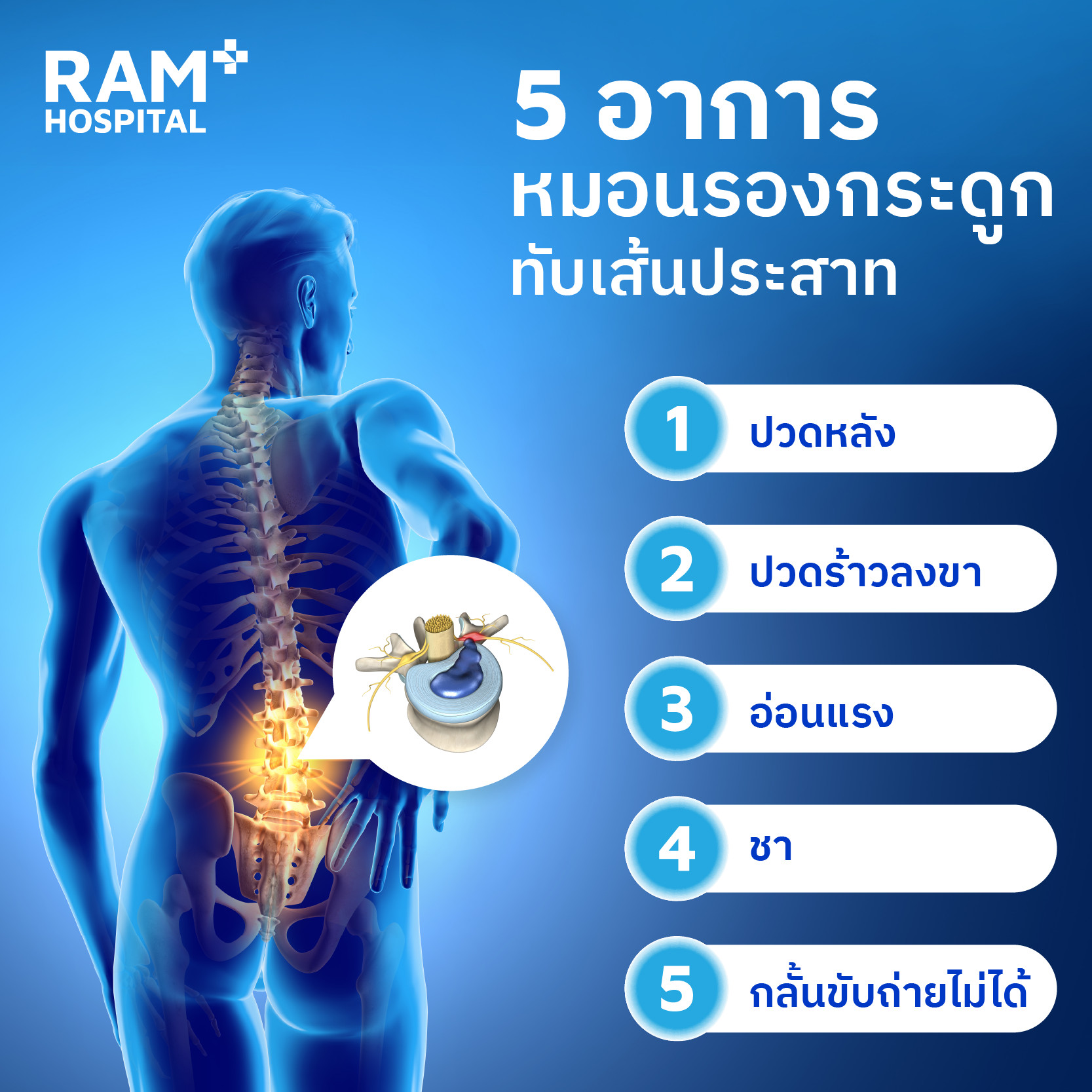 หมอนรองกระดูกสันหลังส่วนเอว