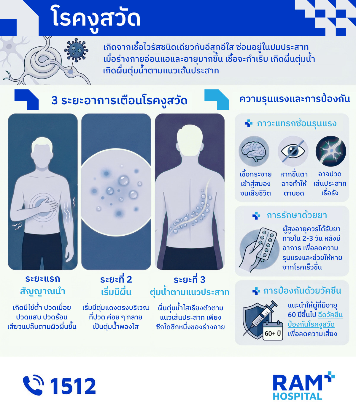 โรคงูสวัด