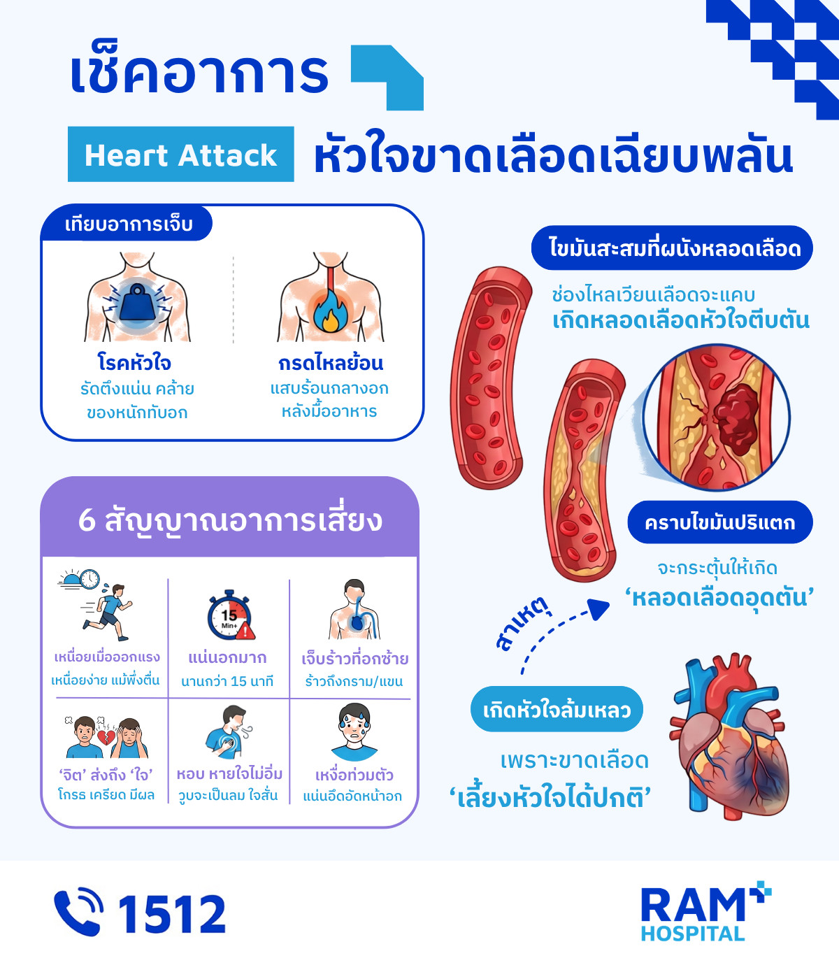 หัวใจขาดเลือดเฉียบพลัน