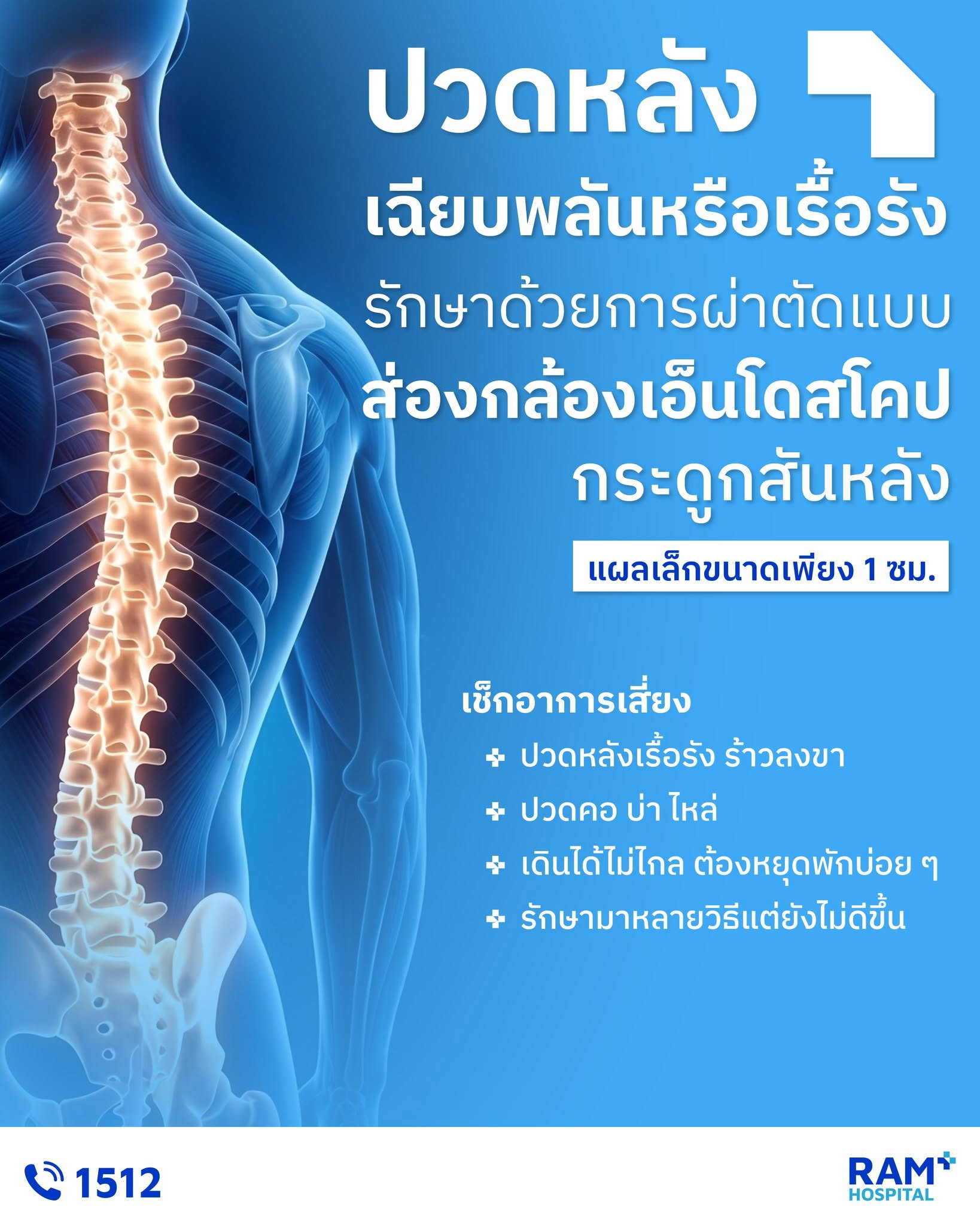 ศูนย์โรคปวดหลัง