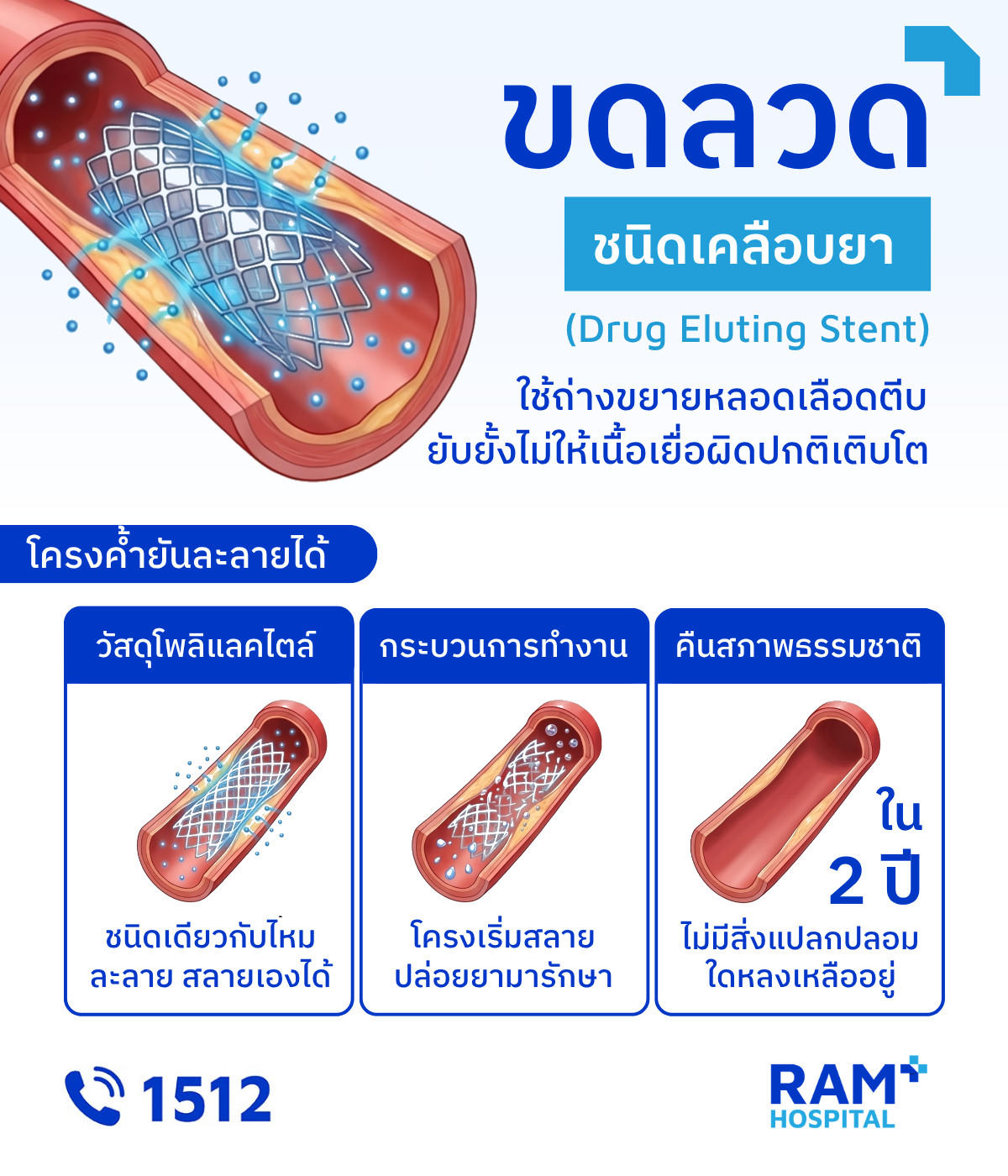 หัวใจตีบ รักษา บอลลูน