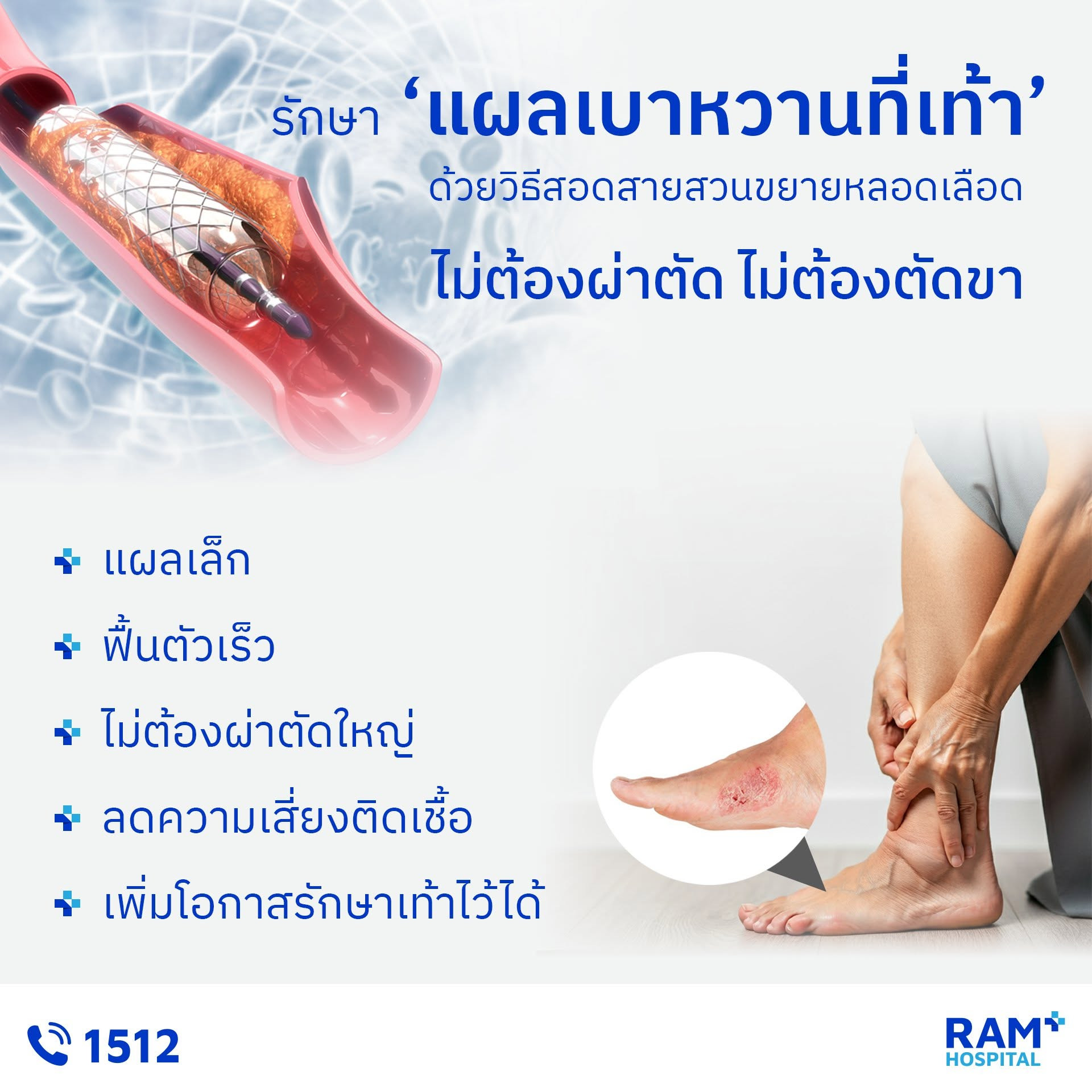 รักษาแผลเบาหวาน