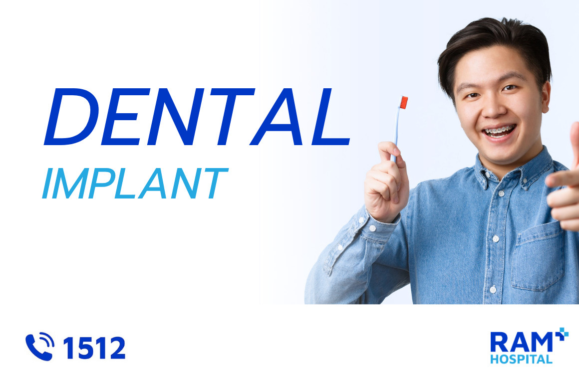 dental implant
