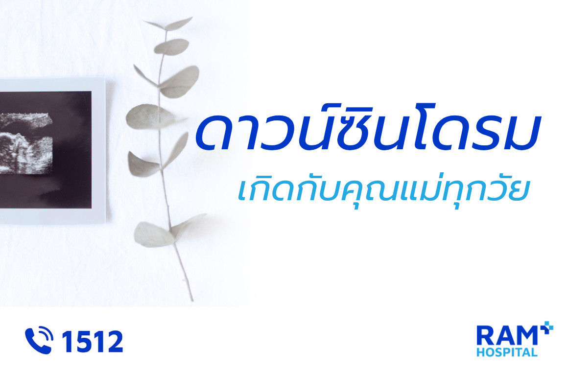 ดาวน์ซินโดรม