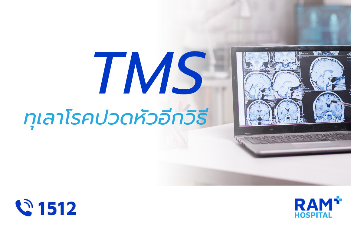 รักษาปวดหัว tms