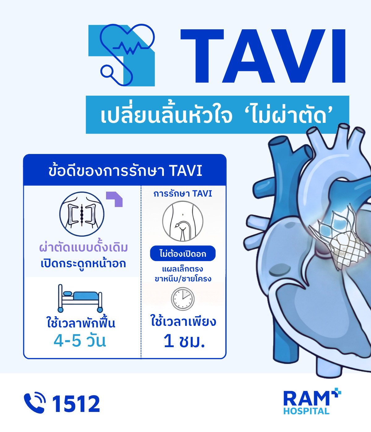เปลี่ยนลิ้นหัวใจ tavi