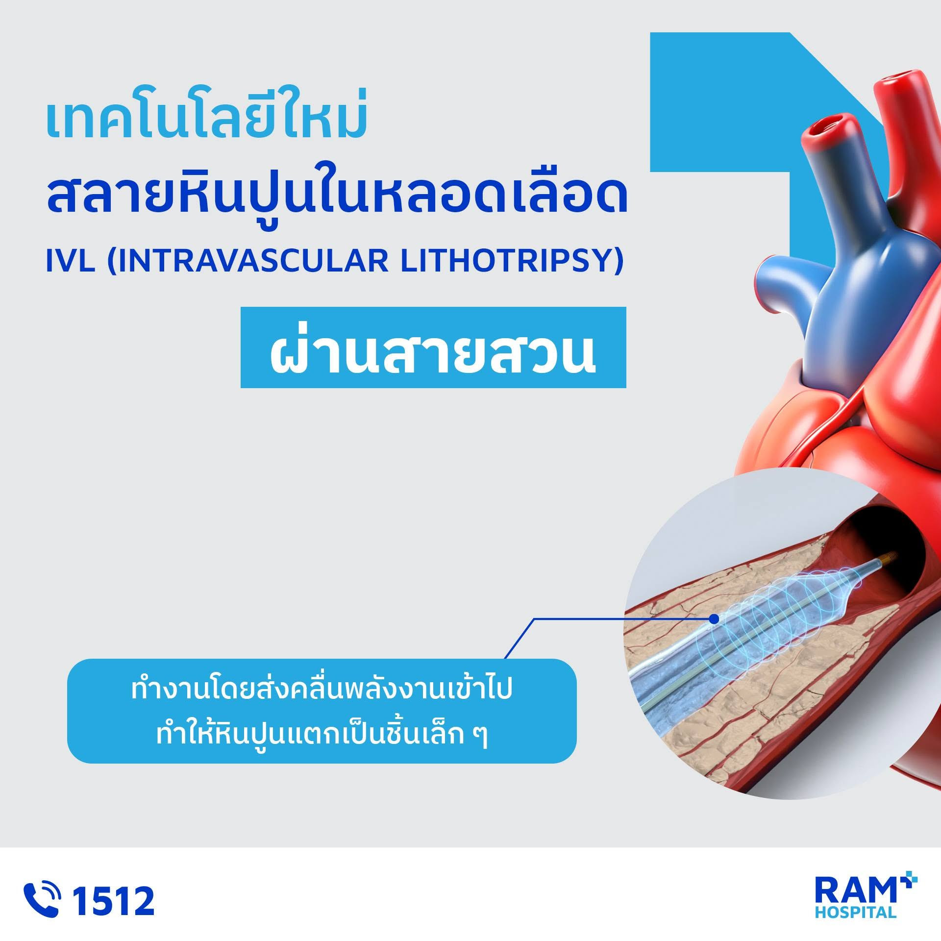 ศูนย์หัวใจ