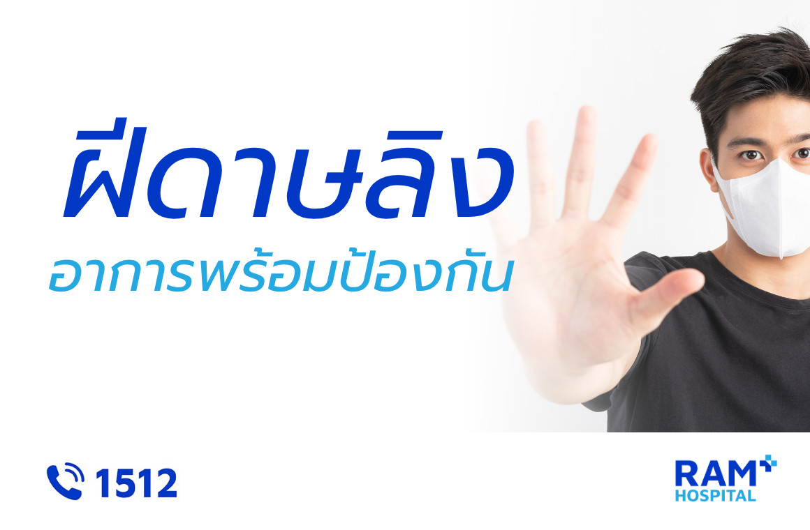 ฝีดาษลิง