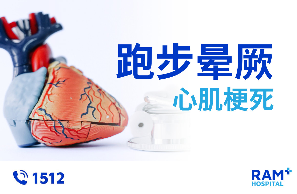 心肌梗死