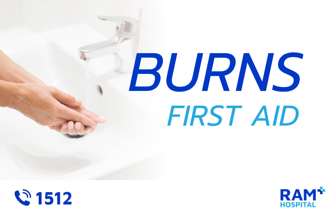 burn first aid